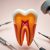 Co to jest endodoncja? Kluczowe informacje o leczeniu zębów