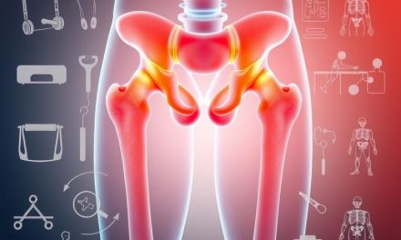Rehabilitacja bioder – znaczenie, etapy i skuteczne techniki